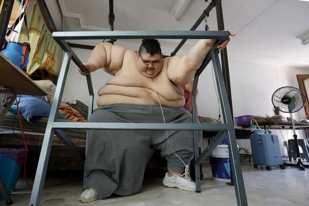 Найтовщий чоловік у світі схуд на 330 кілограмів. Дивіться, як він виглядає