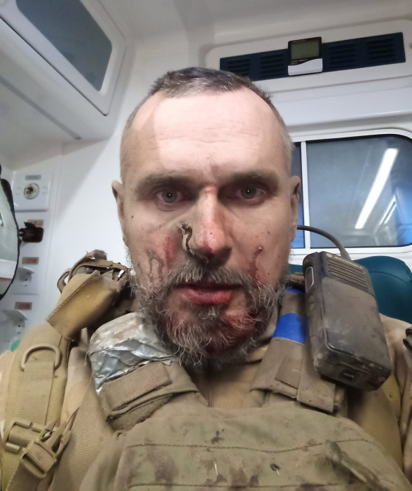 Український режисер Олег Сенцов отримав поранення на Запорізькому напрямку.