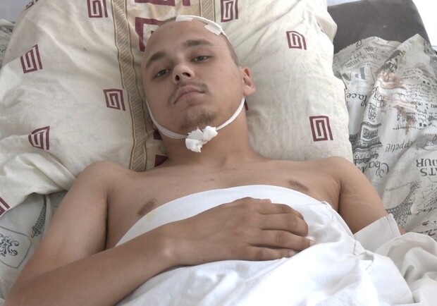 Який стан у хлопця, який був поранений під час ворожого удару по Запоріжжю 9 серпня. 