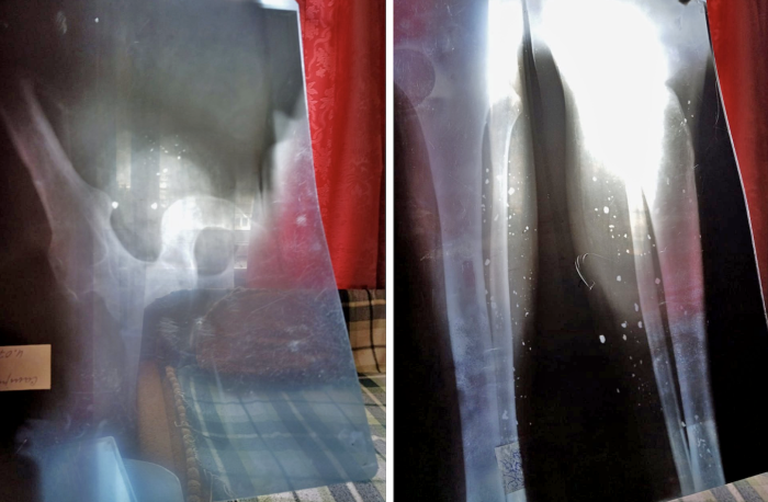 Білі цятки &ndash;&nbsp;це уламки - фото надала мама Юрія