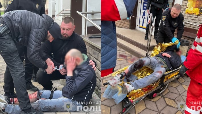 В Запорожье полицейский прострелил ногу нападающему