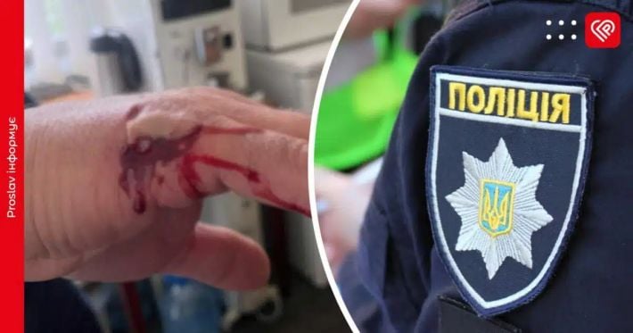 Активистка укусила городского голову Переяслава: мэр вакцинировался, полиция открыла дело
