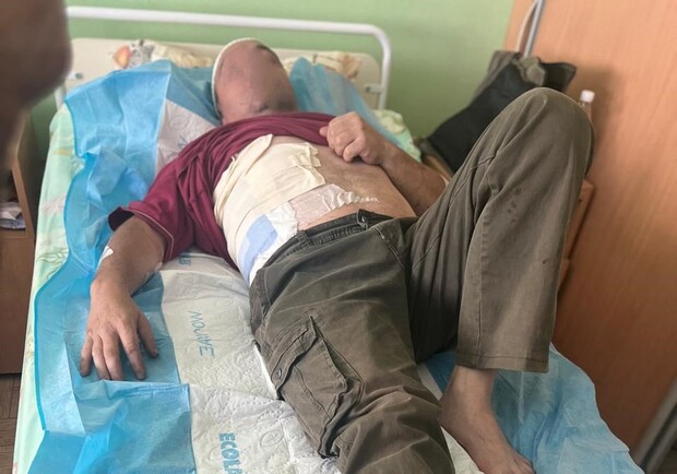 Обличчя постраждалого енергетика приховано з міркувань безпеки. 