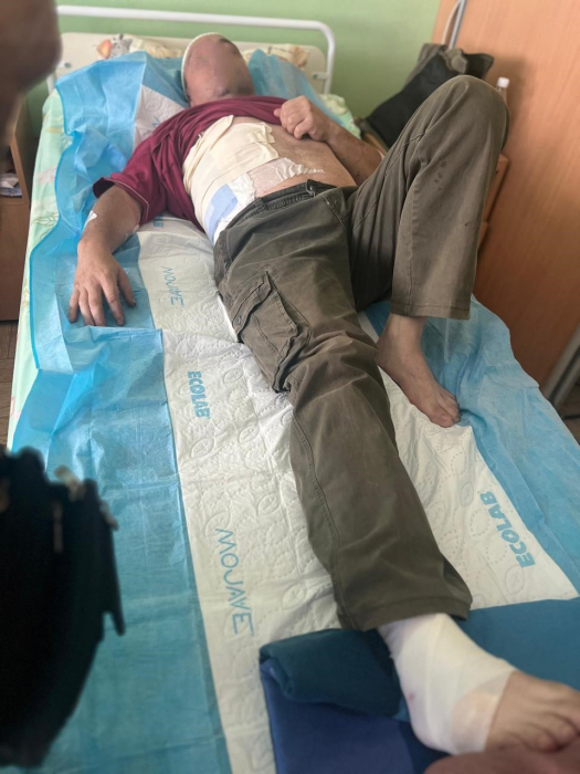 на фото обличчя постраждалого енергетика приховано з міркувань безпеки.