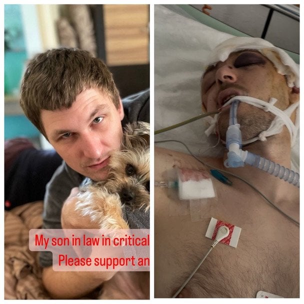 За її словами, медики діагностували у хлопця відкриту черепно-мозкову травму, субдуральні та епідуральні гематоми, а також численні крововиливи. 9