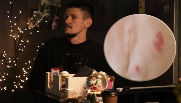 Били ногами по травмированной спине: на Крещатике ограбили ветерана-инвалида из Запорожья