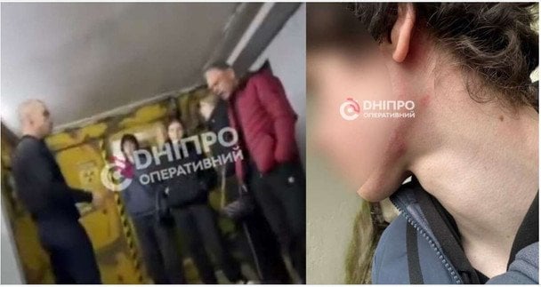 Інцидент закінчився викликом правоохоронців.