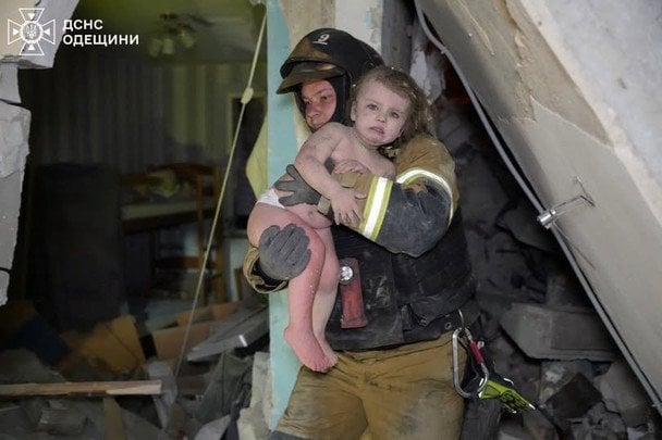 Мати дівчинки дозволила оприлюднити фото без приховування обличчя, аби світ побачив наслідки російських атак.