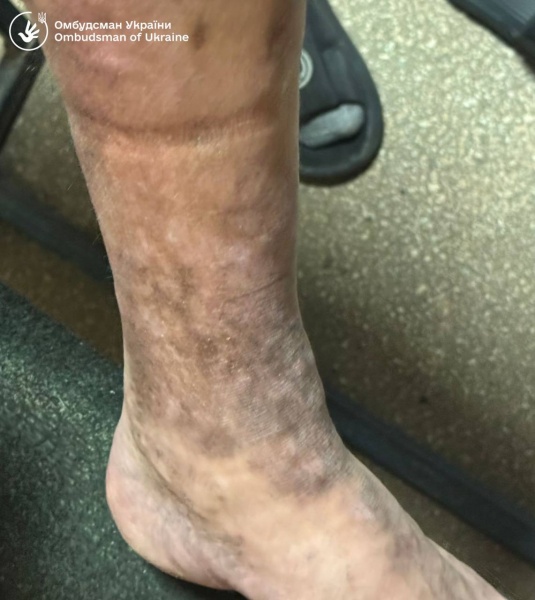 Він додав, що працівники Ужгородського зонального відділу Військової служби правопорядку зрештою сприяли проведенню перевірки.