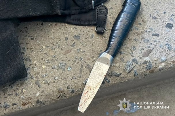 Фахівці з’ясовують усі обставини інциденту, а також причини конфлікту між підлітками.